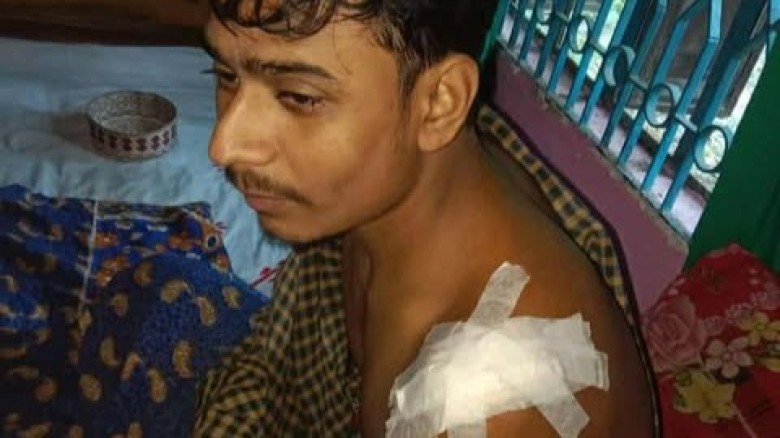 নড়াইলে শিবিরের ইউনিয়ন সভাপতিকে ছুরিকাঘাত।